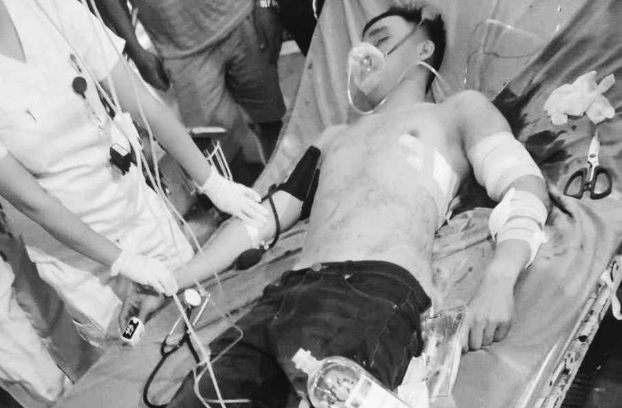 PCG member nabaril sa Basilan, pumanaw sa hospital
