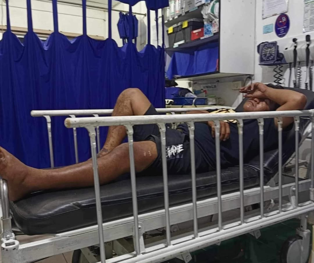 Nakuryente: Isa patay, tatlo malubha